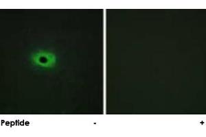 Immunofluorescence analysis of HeLa cells, using SDC4 polyclonal antibody . (SDC4 anticorps  (Ser179))