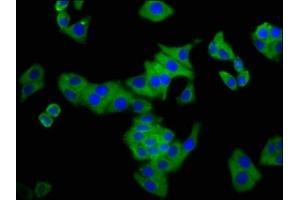 Immunofluorescence staining of HepG2 cells with ABIN7148726 at 1: 133, counter-stained with DAPI. (CSMD3 anticorps  (AA 233-380))