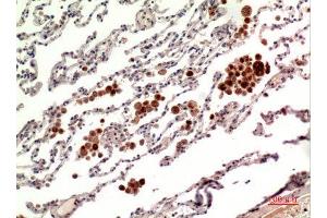 Immunohistochemistry (IHC) analysis of paraffin-embedded Human Lung, antibody was diluted at 1:100. (RANKL anticorps  (C-Term))