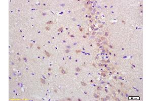 Formalin-fixed and paraffin embedded rat brain labeled with Anti-Cytosine deaminase Polyclonal Antibody, Unconjugated (ABIN682138) at 1:200 followed by conjugation to the secondary antibody and DAB staining (Cytosine Deaminase anticorps)
