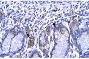 Human Stomach (RBPJ anticorps  (C-Term))