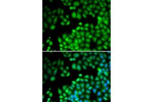 Immunofluorescence analysis of U2OS cells using KMT2E antibody (ABIN5973619).