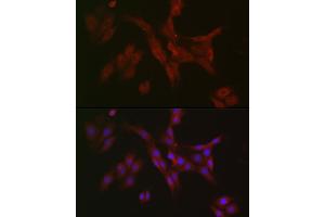 Immunofluorescence analysis of PC-12 cells using RIPK3 Rabbit pAb (ABIN6132598, ABIN6146964, ABIN6146967 and ABIN6221084) at dilution of 1:50 (40x lens).