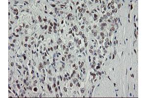 Image no. 16 for anti-Transducin-Like Enhancer of Split 1 (E(sp1) Homolog, Drosophila) (TLE1) (AA 180-460) antibody (ABIN1491050)