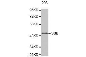 Western Blotting (WB) image for anti-Sjogren Syndrome Antigen B (SSB) antibody (ABIN1874948) (SSB anticorps)