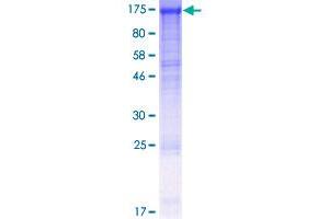 Image no. 1 for Damage Specific DNA Binding Protein 1 (DDB1) (AA 1-1140) protein (GST tag) (ABIN1351255)