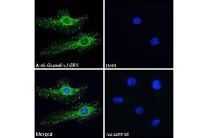 ABIN361185 Immunofluorescence analysis of paraformaldehyde fixed HeLa cells, permeabilized with 0. (Granulin anticorps  (Internal Region))
