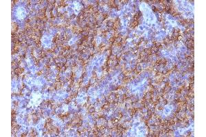 Formalin-fixed, paraffin-embedded human Parathyroid stained with Chromogranin A Monoclonal Antibody (CHGA/765).