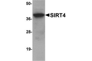 Western blot analysis of SIRT4 in human liver tissue lysate with SIRT4 antibody at 1 μg/ml. (SIRT4 anticorps  (N-Term))