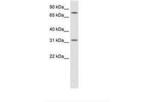 Image no. 1 for anti-Wingless-Type MMTV Integration Site Family, Member 8B (WNT8B) (AA 181-230) antibody (ABIN202313)
