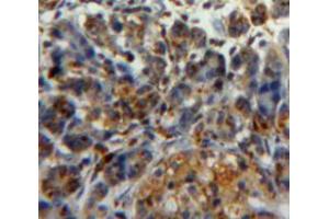 Used in DAB staining on fromalin fixed paraffin-embedded pancreas tissue
