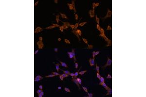 Immunofluorescence analysis of NIH/3T3 cells using UBE2J1 antibody (ABIN7271172) at dilution of 1:100.