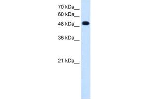 Western Blotting (WB) image for anti-Protein tyrosine Phosphatase, Receptor Type, R (PTPRR) antibody (ABIN2462848) (PTPRR anticorps)