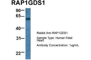 Host: Rabbit  Target Name: RAP1GDS1  Sample Tissue: Human Fetal Heart  Antibody Dilution: 1. (RAP1GDS1 anticorps  (Middle Region))