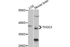 Western blot analysis of extracts of various cell lines, using THOC3 antibody (ABIN6290993) at 1:3000 dilution. (THO Complex 3 anticorps)