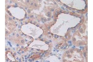 IHC-P analysis of Human Kidney Tissue, with DAB staining. (SLC12A3 anticorps  (AA 3-146))