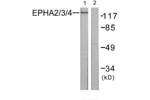 Western Blotting (WB) image for anti-EPH Receptor A2/3/4 (EPHA2/3/4) (Tyr588), (Tyr596) antibody (ABIN1848022) (EPHA2/3/4 anticorps  (Tyr588, Tyr596))