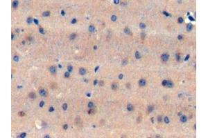 Detection of TAN1 in Mouse Cerebrum Tissue using Polyclonal Antibody to Translocation Associated Notch Homolog 1 (TAN1)