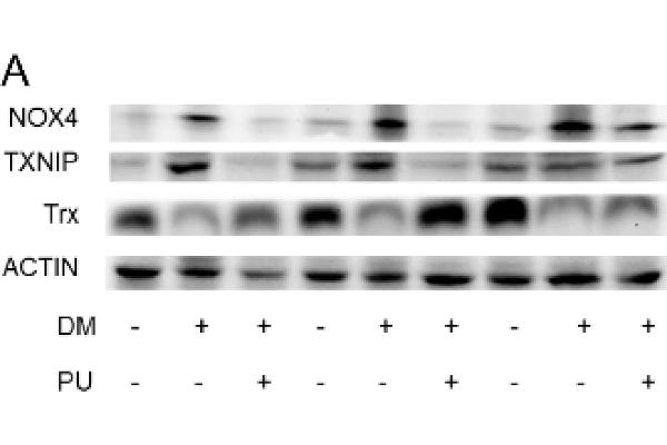 TXNIP anticorps  (AA 1-166)