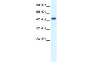 WB Suggested Anti-RCOR3 Antibody Titration:  1.