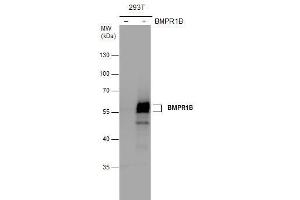 WB Image BMPR1B antibody detects BMPR1B protein by western blot analysis.