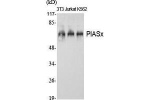Western Blot (WB) analysis of specific cells using PIASx Polyclonal Antibody. (PIAS2 anticorps  (N-Term))