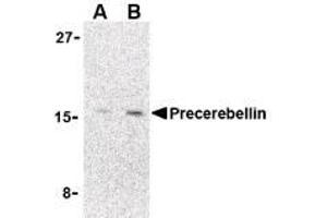 Image no. 1 for anti-Cerebellin 1 Precursor (CBLN1) (C-Term) antibody (ABIN200081)