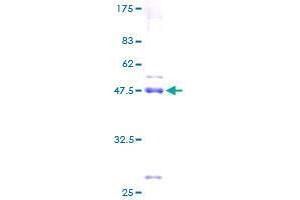 SDS-PAGE (SDS) image for Sorting Nexin 24 (SNX24) (AA 1-169) protein (GST tag) (ABIN1320887)