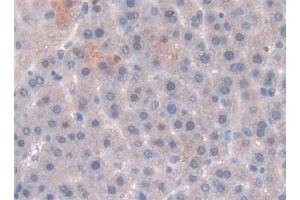 Detection of LEP in Rat Liver Tissue using Polyclonal Antibody to Leptin (LEP) (Leptin anticorps  (AA 22-167))
