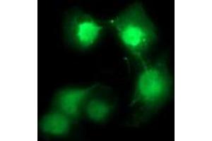 Image no. 2 for anti-Cell Division Cycle 123 Homolog (CDC123) antibody (ABIN1497388) (CDC123 anticorps)
