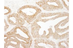 Immunohistochemistry (IHC) image for anti-Epidermal Growth Factor Receptor Pathway Substrate 15 (EPS15) (AA 575-625) antibody (ABIN7448961)