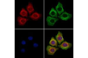ABIN7094425 and ABIN7098472 staining Hela cells by IF/ICC.
