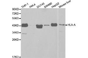 Western blot analysis of extracts of various cell lines, using HLA-A antibody. (HLA-A anticorps  (AA 35-285))