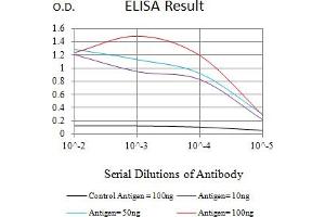 Black line: Control Antigen (100 ng),Purple line: Antigen (10 ng), Blue line: Antigen (50 ng), Red line:Antigen (100 ng)