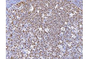 IHC analysis of MCM6 using anti-MCM6 antibody (ABIN7600035). (MCM6 anticorps  (AA 14-821))