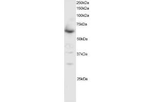 Image no. 1 for anti-SMAD Family Member 4 (SMAD4) (C-Term) antibody (ABIN374104) (SMAD4 anticorps  (C-Term))