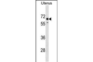 Western blot analysis in human Uterus tissue lysates (35ug/lane). (MMEL1 anticorps  (N-Term))