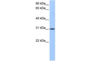 Western Blotting (WB) image for anti-HUS1 Checkpoint Homolog B (HUS1B) antibody (ABIN2463539) (HUS1B anticorps)