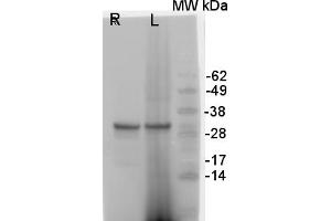 Image no. 1 for anti-ATPase, H+ Transporting, Lysosomal 38kDa, V0 Subunit D2 (ATP6V0D2) (Isoform 1) antibody (ABIN361273)