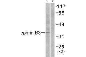 Western blot analysis of extracts from SKOV3 cells, using Ephrin-B3 antibody (#C0182). (Ephrin B3 anticorps)