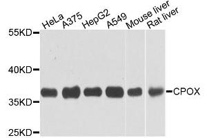 Western blot analysis of extracts of various cell lines, using CPOX antibody. (CPOX anticorps)