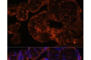 Immunofluorescence analysis of Human placenta using Factor IX / F9 Polyclonal Antibody at dilution of 1:100 (40x lens).