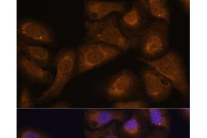 Immunofluorescence analysis of U-2 OS cells using STAR Polyclonal Antibody at dilution of 1:100 (40x lens). (STAR anticorps)