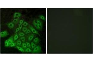 Immunofluorescence analysis of A549 cells, using CSRL1 Antibody. (VN2R1P anticorps  (AA 400-449))