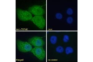 ABIN6391352 Immunofluorescence analysis of paraformaldehyde fixed A431 cells, permeabilized with 0.