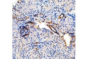 IHC analysis of CD31/Pecam1 using anti-CD31/Pecam1 antibody (ABIN7601662). (CD31 anticorps  (AA 41-258))