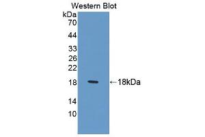 Western blot analysis of the recombinant protein. (LAMB2 anticorps  (AA 1178-1311))