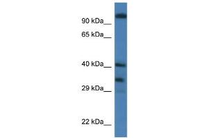 WB Suggested Anti-Morf4l1 Antibody   Titration: 1. (MORF4L1 anticorps  (Middle Region))