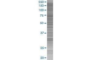 PDGFRA transfected lysate.