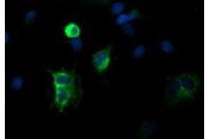 Image no. 4 for anti-Differentially Expressed in FDCP 6 Homolog (DEF6) antibody (ABIN1497809) (DEF6 anticorps)